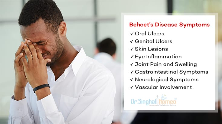 Understanding Behcet's Disease Symptoms and Causes
