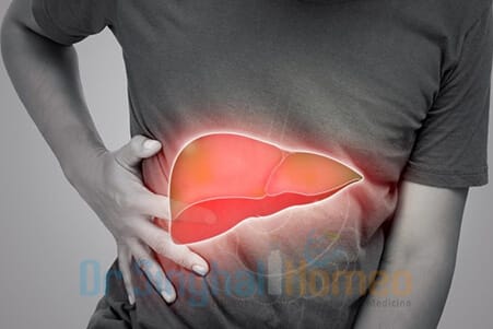CLD Homeopathy Treatment— Safe & Effective Liver Support