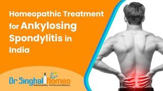 Homeopathic Treatment for Ankylosing Spondylitis–एन्कायलोज़िंग स्पॉन्डिलाइटिस का होम्योपैथिक उपचार