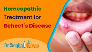 Best Homeopathic Doctor for Behcet's Disease Treatment in India @HomeoDoctor