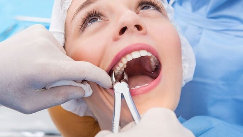 Expert Tooth Extraction in Dubai: Safe, Painless Dental Care | NPR Live