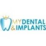 My Dental and Implants