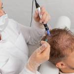 Exosomes Therapy for Hair Loss in Riyadh